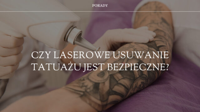 czy laserowe usuwanie tatuażu jest bezpieczne?